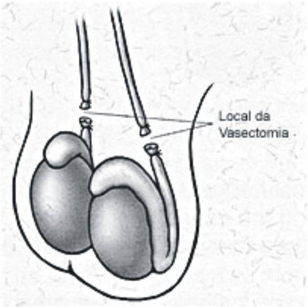Anatomia do sistema reprodutor masculina